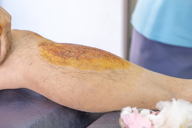 擦伤伤人图片下载