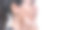 近距离的年轻亚洲妇女担心她的脸，当她有问题的皮肤在她的脸。女性皮肤上有痤疮和疤痕。问题护肤与健康理念。图片下载