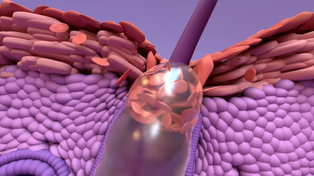 皮肤粉刺或丘疹的形成。
堵塞毛孔中的皮脂促进了某种细菌的生长
人体皮肤层。表皮，真皮层，皮下组织和肌肉。头发，皮脂腺。图片下载