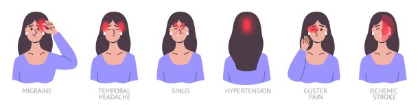 头痛类型。女性肖像与不同部位疼痛。有偏头痛的女孩。痛的头。教育的海报。痛苦的症状。患有高血压。向量疼痛定位集图片下载