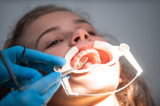 预约牙科诊所的牙医，在牙齿上套上牙套，拉上弓丝来固定图片下载