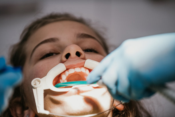 预约牙科诊所的牙医，在牙齿上套上牙套，拉上弓丝来固定图片下载