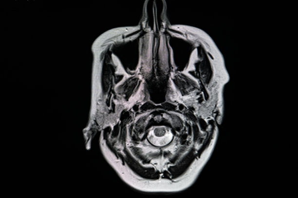 大脑核磁共振扫描。扫描大脑磁共振图像。诊断医疗工具图片下载