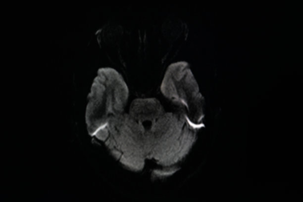 大脑核磁共振扫描。扫描大脑磁共振图像。诊断医疗工具图片下载