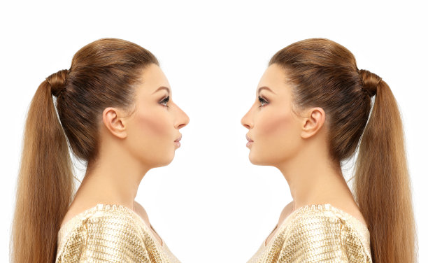 面部美容，鼻子和下巴矫正，鼻整形，基因整形，丰下巴图片下载