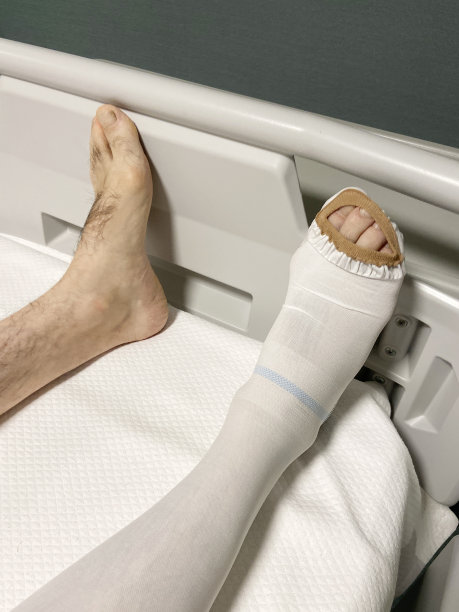 手术腿部，腿部手术患者躺在医院病房的床上图片下载