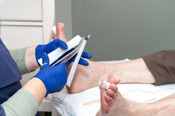护士切割刮宫纱布为一位老年病人的足部进行刮宫手术的特写图片下载