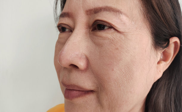 脸颊上的皱纹和瑕疵，眼睑旁的下垂和松弛的皮肤，嘴角边的微笑纹。图片下载