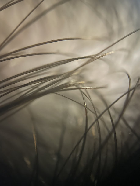 线程，抽象宏照片图片下载