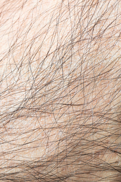 宏观上看人体皮肤和毛发，宏观上看人体毛发图片下载