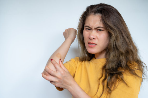 焦虑的女人皮肤上有瘀伤。图片下载