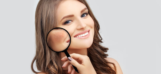 黑斑，雀斑，色素沉着(黄褐斑或黄褐斑)，概念-皮肤提亮，皮肤美白，果酸，AHA，皮肤提亮图片下载