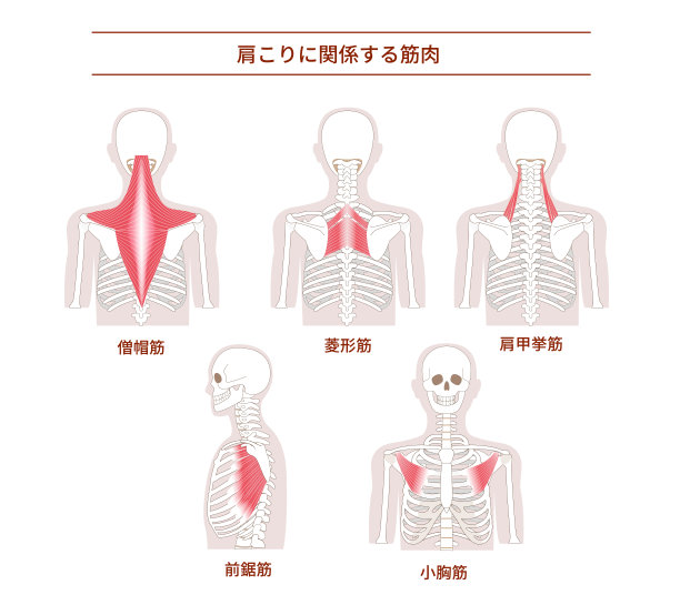 背部的肌肉会导致肩膀紧绷图片下载