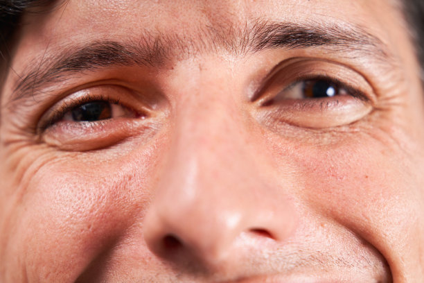 有斜视的年轻人对着镜头微笑。图片下载