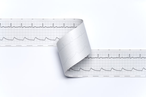 白底常规心电图特写图片下载