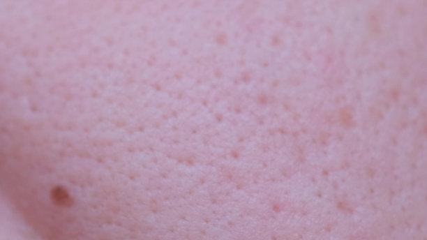 一名男子面部皮肤问题的微距拍摄视频。人体皮肤上的毛孔。皮肤病学的图片下载