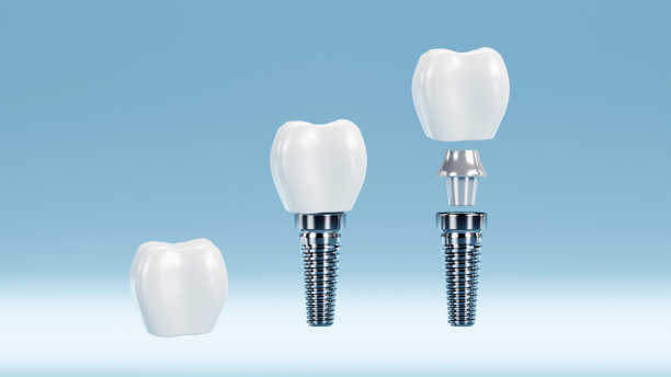 牙齿和口腔种植体为口腔医学设置，种植体手术概念，3D渲染图片下载