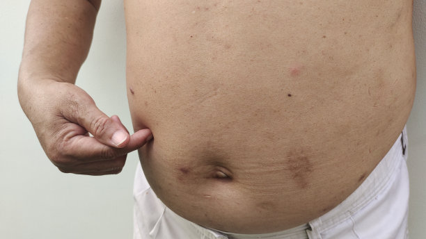 腹部的肥胖、超重和脂肪。图片下载