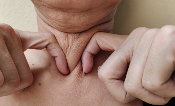 颈部脂肪松弛的皮肤，下巴下的赘肉和松弛的皮肤。图片下载