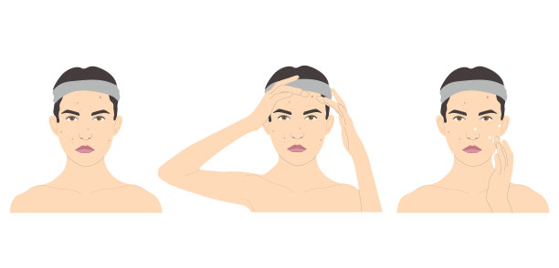 面部美容护理，女性在三种情况下用粉刺和痤疮药物，载体隔离在白色背景上。图片下载