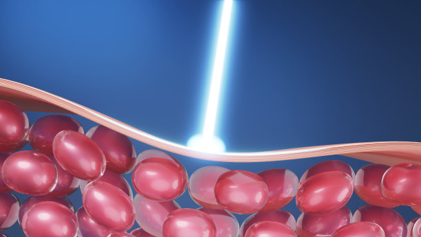 Laser and collagen stimulate图片下载