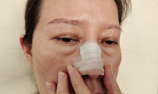 鼻事故，鼻窦和鼻过敏。图片下载