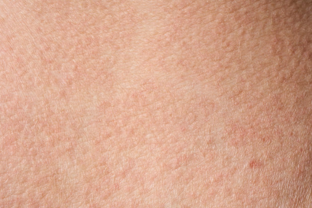 背景是粉红色的皮肤纹理。健康的皮肤。皮肤细胞微距照片。图片下载