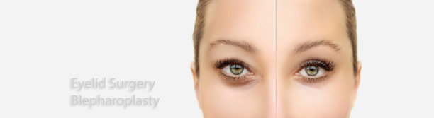 上下眼睑成形术。在脸上做记号。整形外科的概念。图片下载