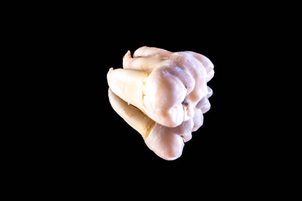 长出48颗下智齿图片下载