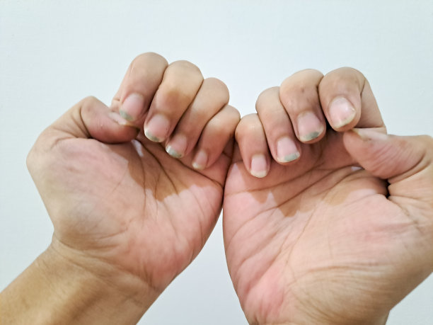 脏的指甲图片下载