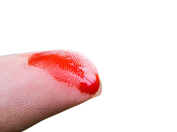近距离观察，白色背景上有血迹的受伤手指图片下载