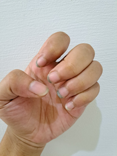 脏的指甲图片下载