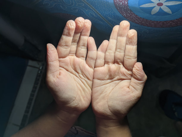 皱纹的手图片下载