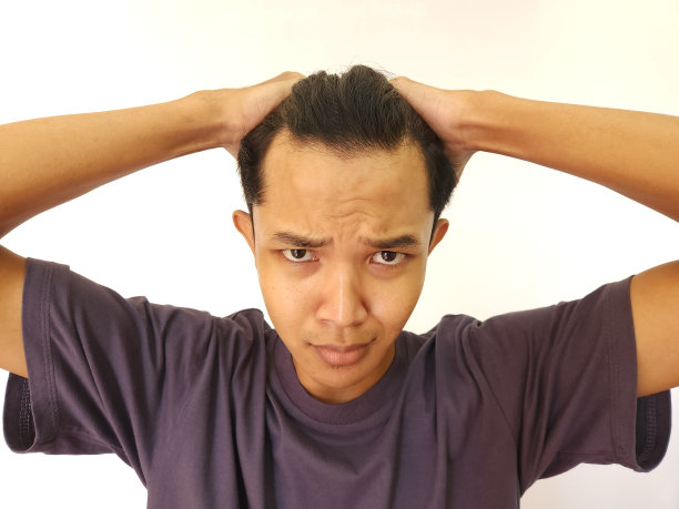 震惊的面孔，亚洲男子秃顶和脱发在孤立的白色背景图片下载