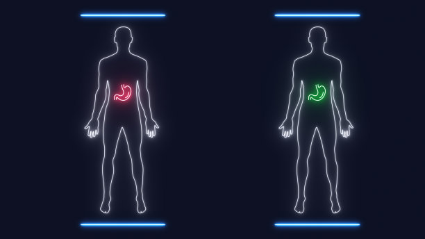 人体解剖扫描分析胃病图片下载