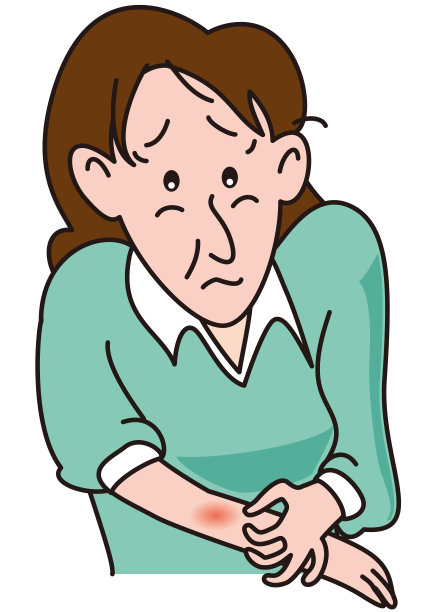 一个手臂上有湿疹的中年妇女。图片下载