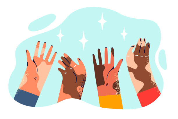 手不同肤色的人受白癜风病后色素沉着障碍的影响图片下载