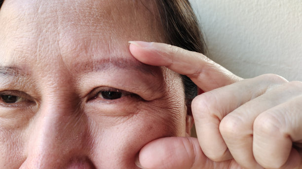 眼睑旁的松弛和皱纹，脸上的黑斑和瑕疵。图片下载