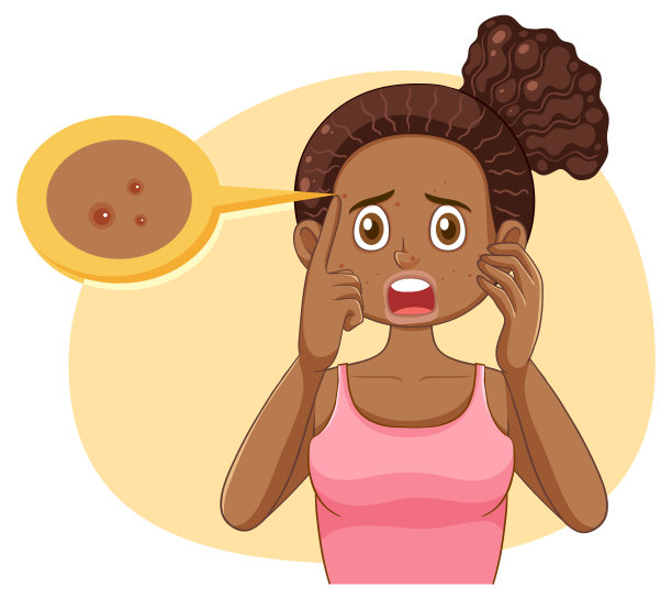 有痤疮问题的少女图片下载