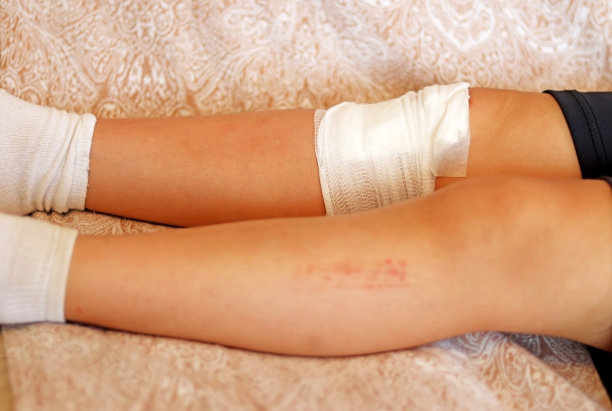 孩子包扎的膝盖。有选择性的重点。图片下载