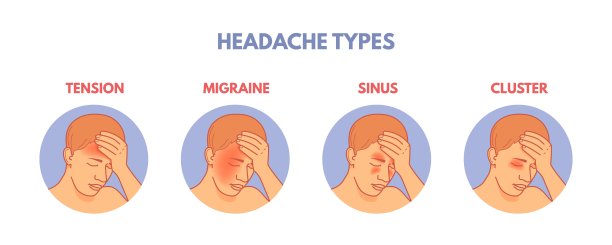 头痛类型。头痛区域信息图医学海报，脑疼痛类型在头部窦性偏头痛的紧张或集群，解剖部分医院病人矢量插图图片下载