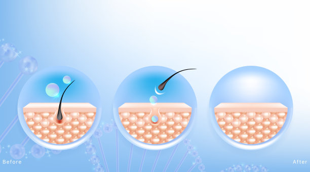 透明质酸前后的头发和皮肤的解决方案广告，蓝色去除血清滴在皮肤细胞与化妆品广告背景准备使用，插图矢量。图片下载