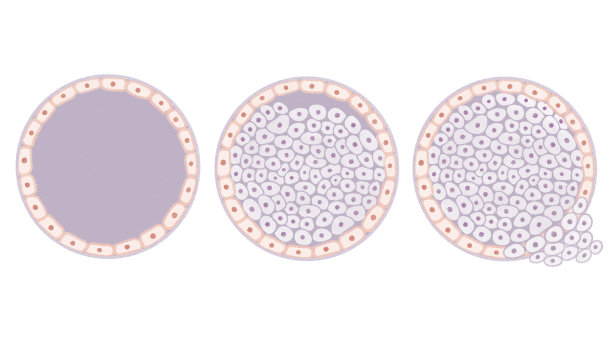乳腺导管癌;本空间图片下载