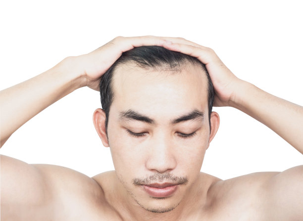 青年男子严重脱发问题与白色背景为保健医疗和洗发产品的概念，选择性重点图片下载