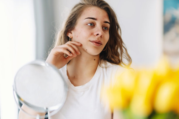 皮肤有问题的年轻女子照镜子。图片下载