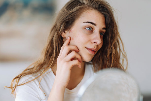 皮肤有问题的年轻女子照镜子。图片下载