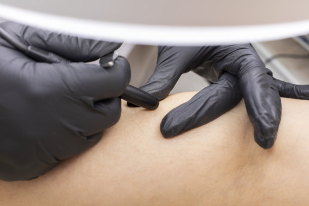 白人年轻女性用电解手脱毛的近景，美容院用电脱毛。水平面。真实的照片图片下载