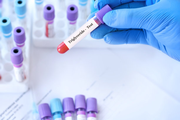 医生拿着一根测试甘油三酯的血样管，背景是医用试管与分析图片下载