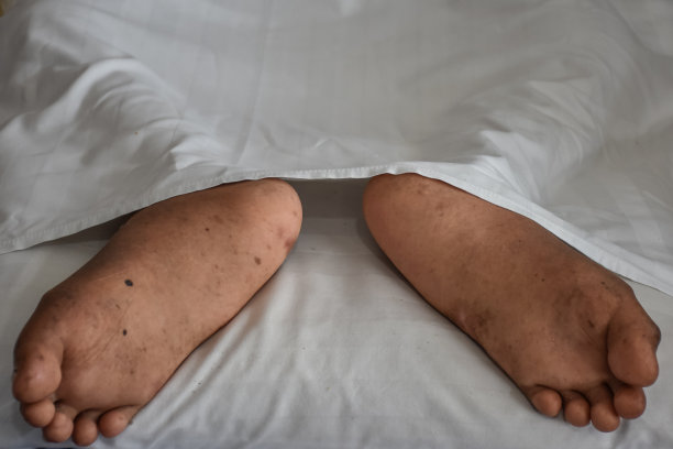 残疾病人脚医院病床。图片下载