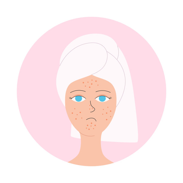 头上裹着毛巾的女孩脸上长了粉刺图片下载